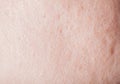 Human face skin texture Royalty Free Stock Photo