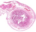 Human fallopian tube