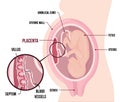 Human Fetus Placenta Anatomy. Usual anatomical Placenta Location During Pregnancy.