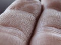 Human Finger Texture