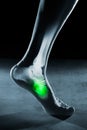Human foot ankle and leg in x-ray, on gray background Royalty Free Stock Photo