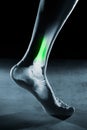 Human foot ankle and leg in x-ray, on gray background Royalty Free Stock Photo