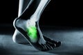Human foot ankle and leg in x-ray, on gray background Royalty Free Stock Photo