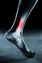 Human foot ankle and leg in x-ray Royalty Free Stock Photo