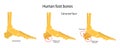 Human foot bones. Plantar and dorsal spur calcaneal spur. Vector illustration Royalty Free Stock Photo