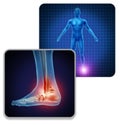 Human Foot Joint Pain Royalty Free Stock Photo