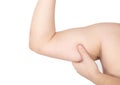 Human forearm biceps on white background, isolate. Muscle amyotrophy Concept. Rehabilitation for biceps and triceps injuries