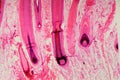 Human hair follicle in skin under the microscope