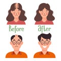 Human hair transplant. Woman and man before and after transplantation. Health care and medicine. Cartoon illustration