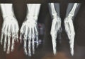 Human hand. Side and oblique wrist of elderly man, Brazil, South, white background