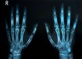 human hands x ray Royalty Free Stock Photo