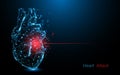 Human heart attack. Heart disease form lines, triangles and particle style design Royalty Free Stock Photo