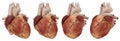 Human heart and coronary arteries