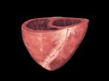 Human heart, cross section, Left and Right Ventricle, Heart ventricles, 3d render