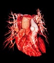 Heart Computed Tomography, CT, radiology Royalty Free Stock Photo