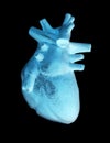Human heart model on black background,concept of cardiology, health care, human organ transplant