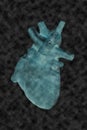 Human heart model on black background,concept of cardiology, health care, human organ transplant