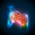 Human hip joint and Osteoporosis Royalty Free Stock Photo