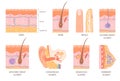 Human Integumentary System Set