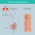 Human Intestinal Parasites.