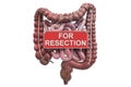 Human intestines with For Resection hanging sign, 3D rendering