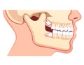 Human jaws model with teeth row. Dentistry