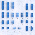 Human karyotype Royalty Free Stock Photo