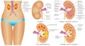 Human kidney anatomy. Royalty Free Stock Photo