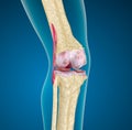 Human knee joint. Royalty Free Stock Photo
