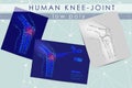 Human knee-joint low poly medicine science illustration set. Knee anatomical pain cure concept. Help keep health drug