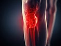 Human knee joint with painful rheumatoid arthritis disease area glowing red. Generative AI