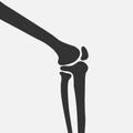 Human knee joint side view Royalty Free Stock Photo