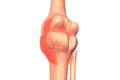 Human knee joints