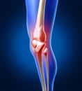 Human Knee Pain Royalty Free Stock Photo