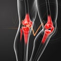 Human knee pain with the anatomy of a leg Royalty Free Stock Photo