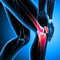 Human knee pain