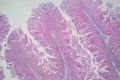 Human large intestine tissue under microscope view. Royalty Free Stock Photo