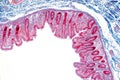 Human large intestine tissue under microscope view Royalty Free Stock Photo