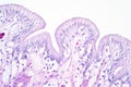 Human large intestine tissue under microscope view