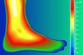 Human Leg. Infrared Thermograph with temperature scale. Infrared energy scan Actual temperature.