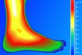 Human Leg. Thermal imager with temperature scale.