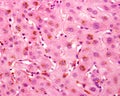Human liver. Cholestasis