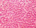 Human liver. Hepatocytes Royalty Free Stock Photo