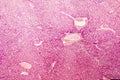 Light micrograph of a human liver