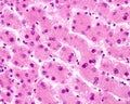 Human liver. Hepatocytes. Trinucleated hepatocyte Royalty Free Stock Photo