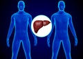 Human liver transplantation. replacement of a diseased liver with a healthy donor liver