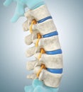 Human lumbar spine model demonstrating normal discs Royalty Free Stock Photo