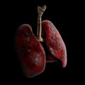 Human Lung anatomy, 3d Illustration on black background