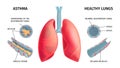 Human Lung Anatomy Infochart