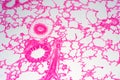 Human lung tissue under microscope view